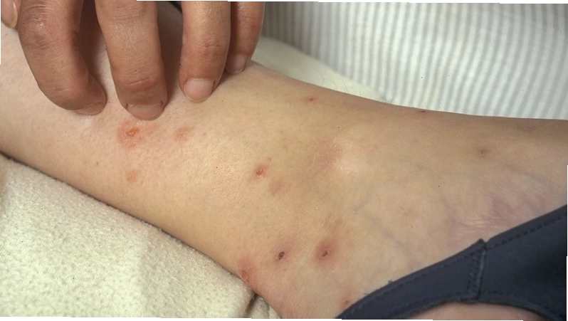 Kiểm tra sức khỏe cho mèo để phát hiện sớm rận